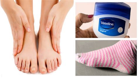 Achieve Spa-Quality Results at Home with Magic Foot Peeling Socks